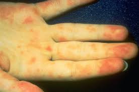 external image clle3_6.jpg&t=1