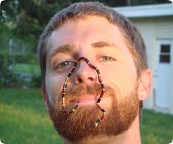 coral snake envenomation