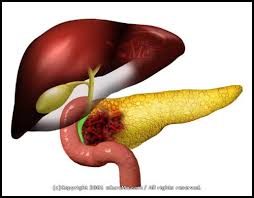 Pancreatic Cancer