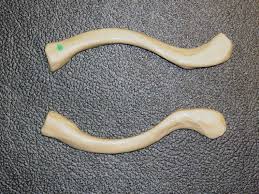 Clavicles -- superior view