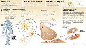 Graphic: What is ALS?