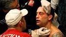 Frankie Edgar