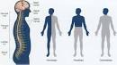 <b>Paralysis</b> - body, causes