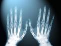 x-rays