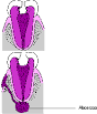 Abcesso <b>periapical</b>