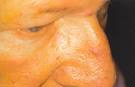 YourDoctor Dermatology Atlas