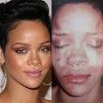 Rihanna Beaten   A Halloween Costume       Pink Celebrity