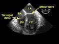 echocardiogram