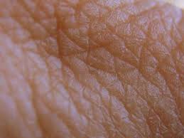 skin wrinkle