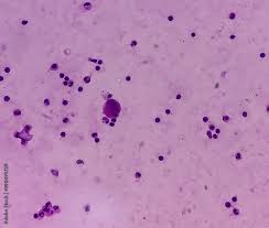 Image result for proteinaceous