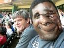 Reggie has neurofibromatosis.