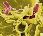 <b>Salmonella infections</b> are