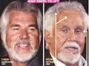 The 15 Worst Celebrity Plastic Surgery    FOOYOH ENTERTAINMENT