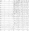 220px-Spike-waves.png