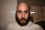 I wanted to be bald again,