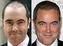 James Nesbitt gets a new head