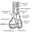 Lucent Lesions of Bone — Musculoskeletal Radiology — UW Radiology