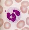 Neutropenia | Onco Link Cancer Resources
