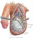 Testis and Epididymis - Netter Medical Images