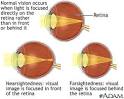 Normal, nearsighted, and farsighted vision -