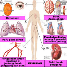 images?q=tbn:ANd9GcQ9rHYhvK6o4dtJehpEGmoCJVEsjo91GHrJ0lEf56ZMJd6zQHyQXw