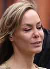 Tara Palmer-Tomkinson attempts to shield drug-ravaged nose on.