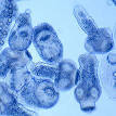 Echinococcosis - Wikipedia, the free encyclopedia