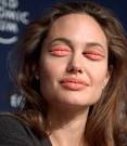 Weird Pictures Of CELEBRITIES With Lips Instead Of Eyes | The ...