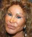 The 15 Worst Celebrity Plastic Surgery Disasters You Will Ever See