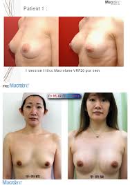 http://t3.gstatic.com/images?q=tbn:ANd9GcQF0dqTQHYAydezKwOIWre8sR22TeTURlD-CkaNmaxo6FGZ8VRjgg