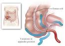 CASE AND COMMENTARY: "Recurrent" Appendicitis - Wellsphere
