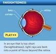 Hyperopia (Farsightedness) - AllAboutVision.