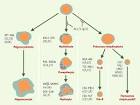 <b>Leucémie</b> Aiguë Lymphoblastique