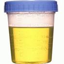 Urine Specimen Cup | Urine Specimen Collection | Bulk | Urine ...