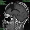 Esempio di <b>imaging</b> a <b>risonanza</b>