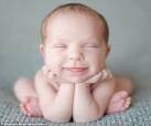 Deviated septum in babies