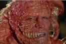 Slither