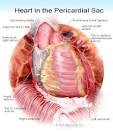 HEART TRANSPLANT Surgery and Procedure Information by MedicineNet.