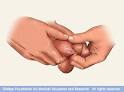 Mayo Clinic medical information and tools for healthy living ...
