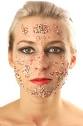 Remove Pimples From Face
