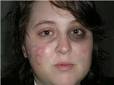 She drew a B on her face,
