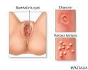 Red Bumps In Vaginal Area - Doctor answers on HealthTap