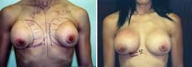 http://t3.gstatic.com/images?q=tbn:ANd9GcQM6T005knYI8tcIYpo835t1DjVSc-dHUGwqy5F3JhG8546fsMfaTyaQM4