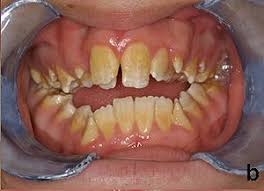 http://t3.gstatic.com/images?q=tbn:ANd9GcQNtcOu6OxfJxE5EW5JAnIHyDSXYojg7CC38NKArLSWgog3hDw&t=1&usg=__klXoWluvUGTctyF90PgQXwc3O1Q=
