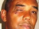 Moya was handcuffed, beaten