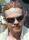 hair line is just as bad!