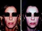 (B) Post-operative view of