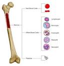 Bone Marrow Transplantation in Children