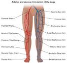 Revised guidelines for Deep Vein Thrombosis prophylaxis in long ...