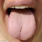 <b>Tongue</b>